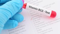 Jangan sepelekan fungsi vitamin B, kandungan B12 dapat membantu hati dalam detoksifikasi. Oleh karena itu, pastikan Anda sudah memenuhi kebutuhan vitamin B12 harian, dilansir Health. Foto: Ilustrasi/Thinkstock