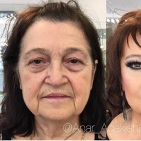 Melalui akun Instagram, @anar_agakishiev, ia pun kerap membagi foto before-after yang mengejutkan sekaligus buat kagum. Foto: Instagram Anar Agakishiev