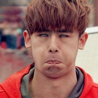 Dengan kondisi mata yang seperti itu, wajah Nichkun 2PM terlihat lucu. Foto: Istimewa