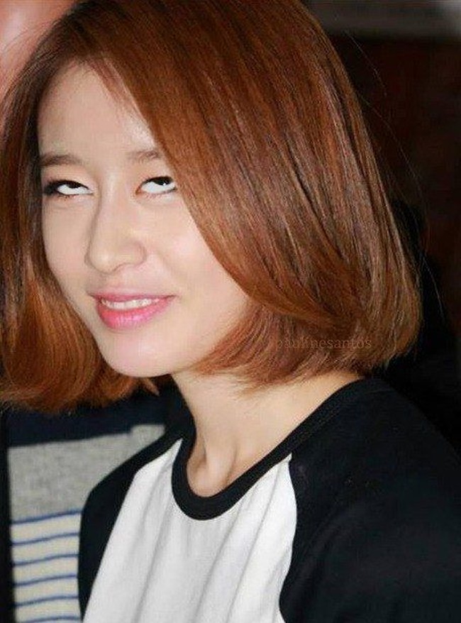 Apakah Jiyeon T-ARA masih tetap cantik jika terlihat seperti ini? Foto: Istimewa