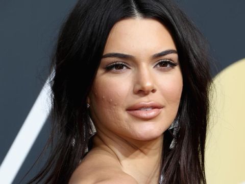 Ini Kata Kendall Jenner Soal Penapilan Jerawatan di Golden Globes 