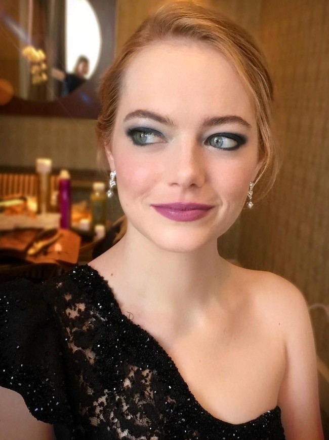 Aktris Emma Stone pernah mengatakan kepada Refinery 29 bahwa dirinya melakukan suntik kortison untuk mengobati jerawat yang timbul di wajahnya. Suntikan kortison dari dokter kulit dapat membuat jerawat yang sulit sembuh, seperti cystic acne dapat diatasi hanya dalam beberapa hari saja. Suntikan kortison mengandung steroid yang dapat melawan peradangan. Foto: dok. Instagram (Rachel Goodwin)