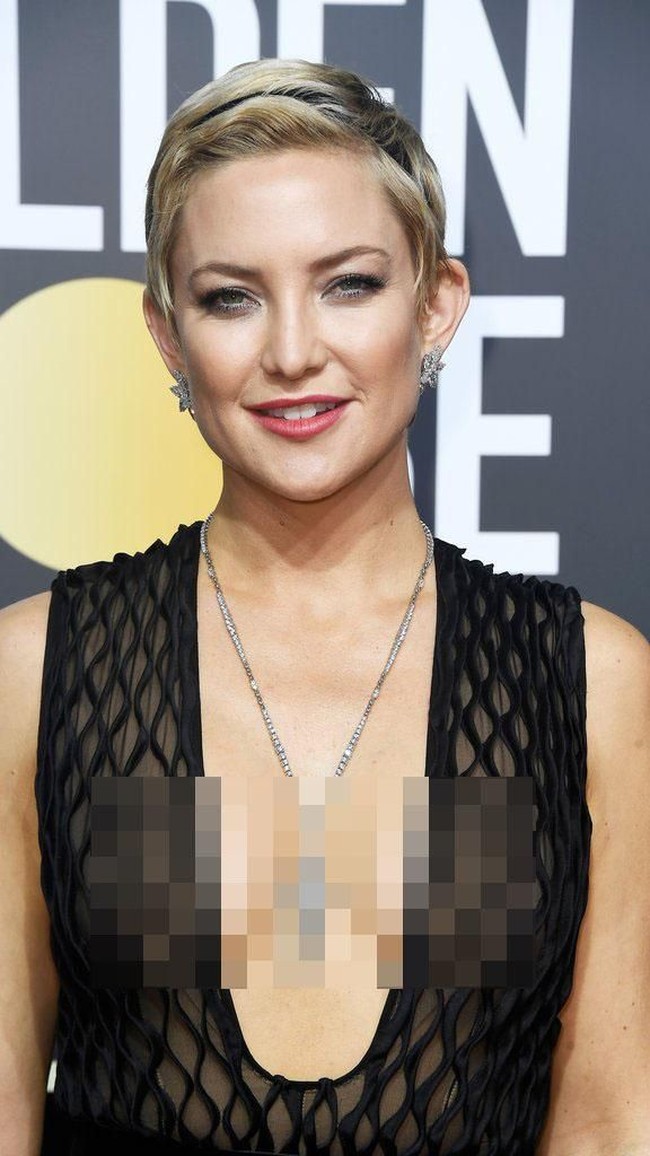 Pamer rambut pendek, Kate Hudson tetap memukau. Foto: Getty Images