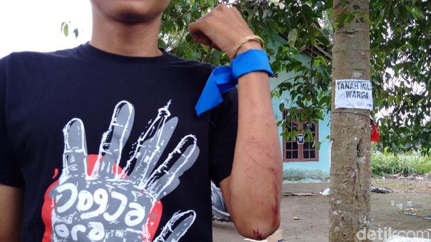 Heron menunjukkan luka di kepala dan tangannya akibat kericuhan.