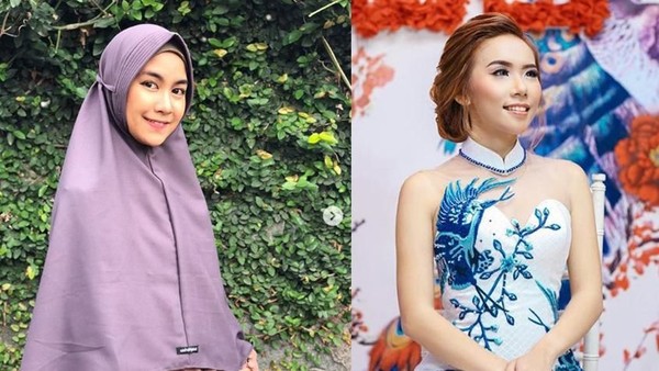 Cantiknya Anisa Rahma dan Cherly Juno yang Disinggung Joshua Suherman