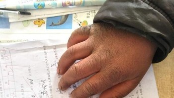Tangannya di atas soal ujian di kelas. Bocah ini juga harus membantu neneknya di ladang sepulang sekolah sehingga kedua tangannya menjadi seperti itu. Foto: Peoples Daily