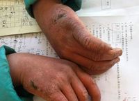 Viral, Bocah SD Berjuang Sekolah Sampai Rambut Membeku