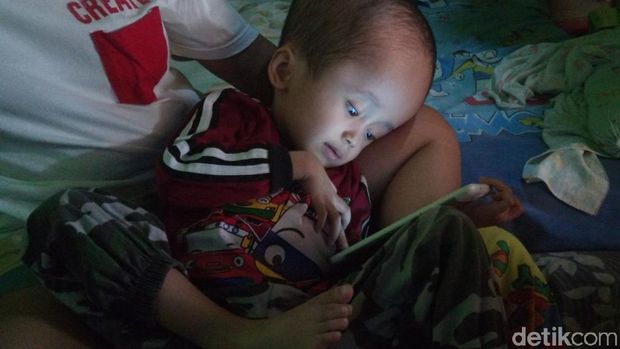 Kisah Rahman, Bocah Penderita Hidrosefalus asal Rancaekek Bandung