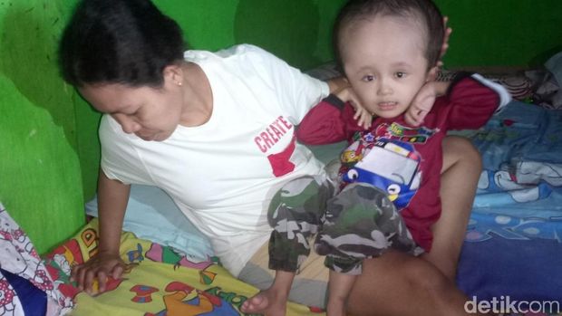 Kisah Rahman, Bocah Penderita Hidrosefalus asal Rancaekek Bandung