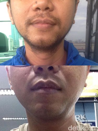 Sensasi Bercukur Tanpa Khawatir Kulit Wajah Terluka