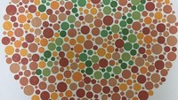 Dyschromatopsia adalah kondisi ini biasanya memiliki penglihatan yang sangat baik namun kesulitan membedakan antara warna merah dan hijau. Dalam kasus yang jarang terjadi, orang tidak dapat membedakan antara nuansa biru dan kuning. (Foto: Instagram/eyedoctor_woo)