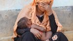 Potret Anak-anak Rohingya yang Menderita Gizi Buruk