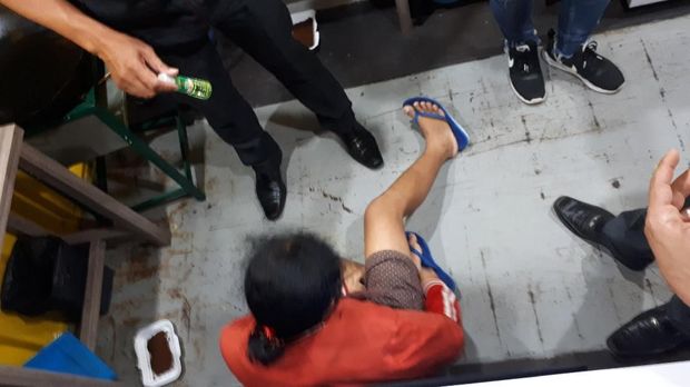 Foto: Kondisi bayi mengalami luka di bagian leher.