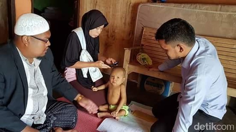 Akbar Penderita Atresia Bilier di Lhokseumawe Butuh Bantuan Akbar Penderita Atresia Bilier di Lhokseumawe Butuh Bantuan