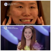 Han Sul Hee adalah seorang penyanyi luar biasa yang memimpikan menjadi aktris musikal, namun karena rahangnya terlalu lebar dan wajahnya dianggap tak menarik, ia pun diusir saat menjalani audisi. Dilansir Koreaboo Sul Hee mengaku telah mempertimbangkan operasi plastik, tapi takut akan merusak suaranya. Foto: Istimewa