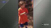 Pihak rumah sakit menyebut Ryker terkena Milwaukee protocol atau rabies yang menyerang manusia.  (Foto: Dok. WFTV via ABC News)