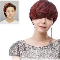 Pyo Ga Hee dijuluki sebagai Gadis Setengah Wajah. Ga Hee didiagnosis retinoblastoma sejak kecil dan harus menjalani perawatan kemoterapi ekstensif yang mempengaruhi pertumbuhan kulit di wajah, hal itu menyebabkan mata dan mulutnya tidak berkembang. Bagaimana penampilan Ga Hee setelah rekonstruksi wajah?Foto: Istimewa