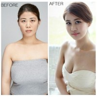 Jang Se Yul datang ke acara reality show Let Me In untuk menjalani operasi pengecilan payudara setelah menjalani hidup sulit karena payudaranya sangat besar.Foto: Istimewa