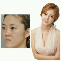 Kim Eun Ae mengeluhkan bahwa ia tidak menarik sebagai seorang istri dan ibu. Lebih dari itu ia juga mengalami kesulitan untuk berbicara dan mengunyah makanan karena rahangnya yang terlalu menonjol. Setelah operasi, Eun Ae mengatakan bahwa dia tidak dilahirkan kembali sebagai istri cantik, tapi sebagai wanita yang percaya diri. Foto: Istimewa