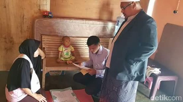 Akbar Penderita Atresia Bilier di Lhokseumawe Butuh Bantuan