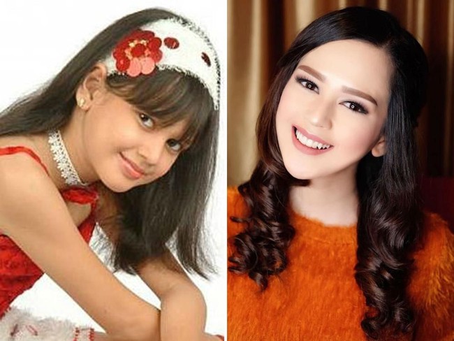 Cut Meyriska lahir di Medan Pada 26 Mei 1993. Wajah imut Cut Meyriska tak pernah berubah hingga dewasa. Ia ternyata memliki aura bintang sejak masih kecil. (Foto: Ist, Instagram)