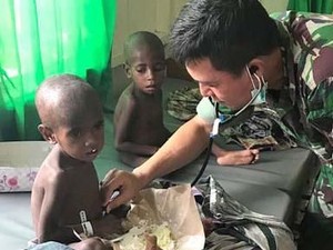Marak Gizi Buruk di Pelosok Papua, Jokowi akan Relokasi Warga ke Kota