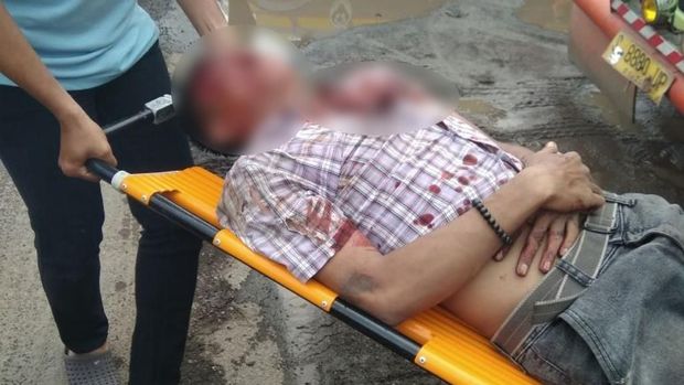Belum diketahui identitas maupun penyebab luka pada pria itu