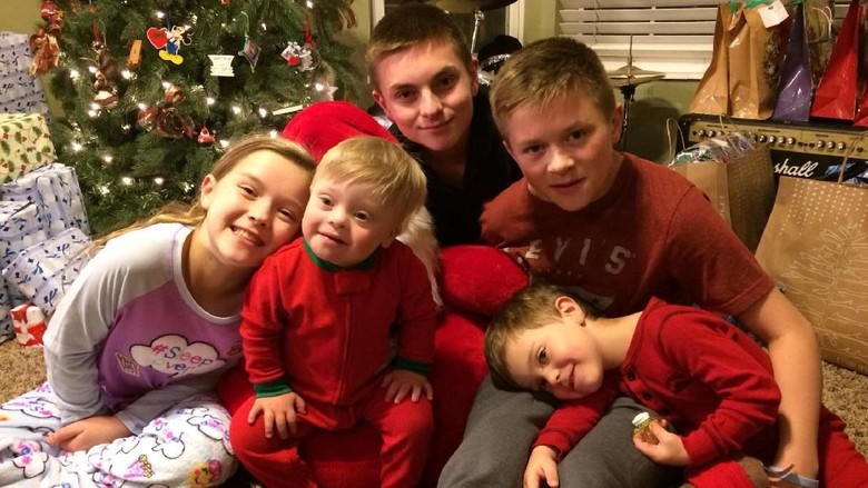 Kakak menghibur adiknya yang down syndrome (Foto: Facebook/ Amanda Bowman Gray) Kakak menghibur adiknya yang down syndrome (Foto: Facebook/ Amanda Bowman Gray)
