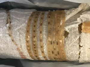 Cacing Pita 1,7 Meter Keluar dari Tubuh Pria Penggemar Sushi