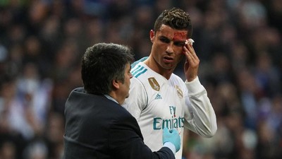 Foto: Ronaldo Berdarah-darah di Bernabeu