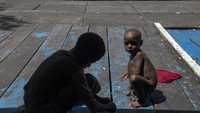 Seorang anak menunggu antrean pemeriksaan kesehatan di Rumah Sakit Umum Daerah (RSUD) Agats, Kabupaten Asmat, Papua, Senin (22/1). Penderita gizi buruk dan campak ini membutuhkan penanganan yang serius oleh pemerintah pusat. Foto: AntaraFOTO/Agung Rajasa