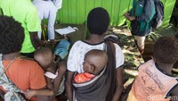 Jumlah anak penderita gizi buruk dan campak yang dirawat sebanyak 85 orang diantaranya di RSUD Agats 40 anak dan 45 anak di aula gereja Protestan Indonesia. M Agung Rajasa/Antara Foto.