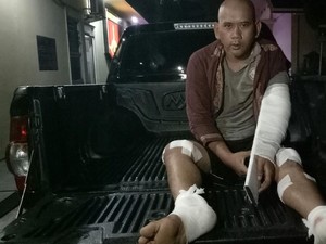 Jejak Perampok 8 Kg Emas: 3 Ditembak, 1 Buron