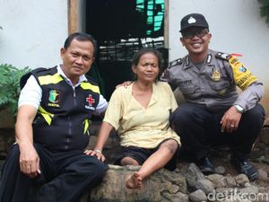 Hidup Serba Kekurangan, Hotima Butuh Bantuan Kaki Palsu