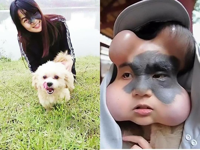 Terdapat empat implan balon di wajah Xiao Yan. (Foto: Facebook/Chidozieblog) Terdapat empat implan balon di wajah Xiao Yan. (Foto: Facebook/Chidozieblog)