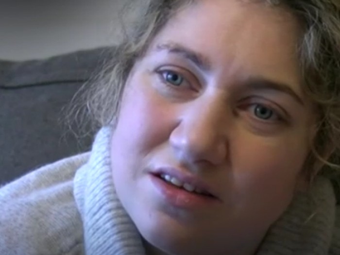 Punya Sindrom Muntah Siklik, Wanita Ini Bisa Muntah Enam Kali Sejam