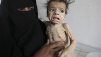 Seorang ibu bersama bayinya di fasilitas rehabilitasi nutrisi di Yaman. (Foto: Reuters/Mohamed al-Sayaghi)