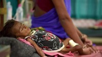 Bayi dua bulan bernama Jyoti terbaring lemas di rumah sakit. Masalah gizi buruk disebut melanda India karena maraknya pernikahan dini. (Foto: Reuters/Poulomi Dey)