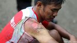 Pebalap Bertumbangan di Etape Neraka