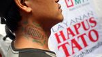 Foto: Ratusan Orang Ikuti Layanan Hapus Tato