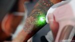 Foto: Ratusan Orang Ikuti Layanan Hapus Tato