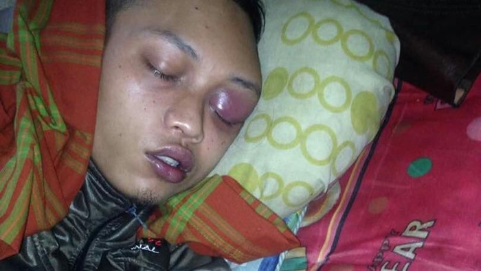 Kesulitan Berobat, Zulfikar TKI di Malaysia akan Dipulangkan