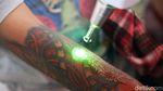 Foto: Ratusan Orang Ikuti Layanan Hapus Tato