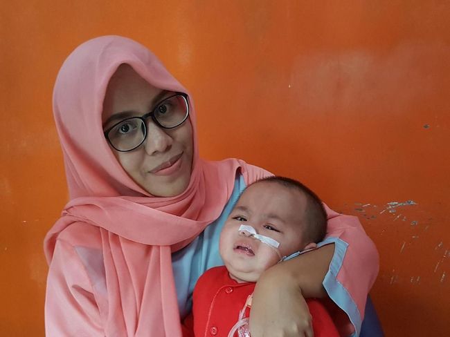 Cerebral Palsy Bikin Bayi Cantik 9 Bulan Ini Belum Leluasa 