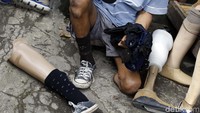 Kaki palsu tersebut benar-benar membantu mereka untuk berjalan bahkan berkendara. Foto: Rachman Haryanto