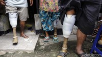 Ada sekitar 23 mantan pasien kusta di kampung Sitanala Tangerang yang menggunakan kaki palsu. Foto: Rachman Haryanto
