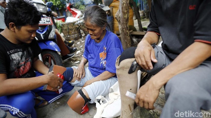 Mantan pasien kusta yang kehilangan kaki. Foto: Rachman Haryanto Mantan pasien kusta yang kehilangan kaki. Foto: Rachman Haryanto
