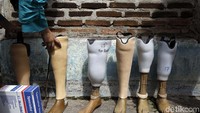 Kebanyakan pasien kusta ada organ tubuhnya yang diamputasi, terutama kaki akibat terinfeksi bakteri Mycobacterium leprae. Hal ini lah yang membuat mereka harus menggunakan kaki palsu. Foto: Rachman Haryanto