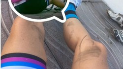 Potret Kaki Berotot Penuh Urat Orang Orang Yang Rajin Bersepeda