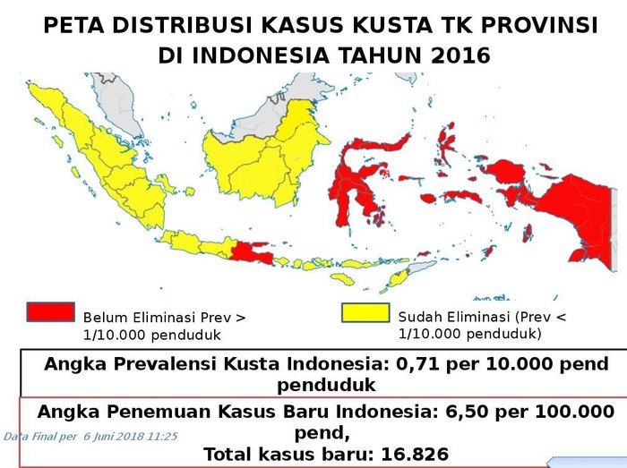 Indonesia Bertekad Eleminiasi Kusta di Tahun 2019